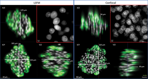 Figure 2. Comparison of imaging quality using LSFM and confocal microscopies. The same human islet was imaged with both microscopes, with if for insulin (green) and nuclei (Hoechst, white). The position varies as it is impossible to acquire systematically from the same angle with two different microscopes. Bottom left of each data set: 2D cross-section in the middle of the islet (X/Y view). Top-left and bottom right: X/Z and Y/Z orthogonal projections. Top right (red square): magnification of Hoechst-labeled nuclei in X/Y. Image resolution was superior in confocal microscopy, with overall crispier staining. However, this was detrimental to proper nuclear segmentation in DIA, requiring additional pre-processing steps. Orthogonal projections highlight the flattening of the sample in z and spherical aberrations when using confocal microscopy.