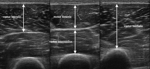 Figure 1. Ultrasound images of the quadriceps muscle.