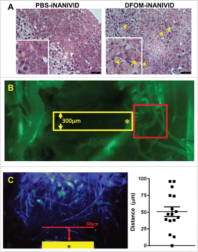 Figure 7. Physiological Effects of iNANIVID. (A) Tissue remains viable days after implantation of device. Histological (H&E) staining of HEp3 tumors after 3 days of being exposed to PBS or DFOM-loaded iNANIVIDs. Insets added to show detail. Neither implant shows signs of necrosis or apoptosis, while the DFOM exposed tissue shows a higher density of blood vessels (arrows). (B) Vascular perfusion near outlet is preserved after insertion of device. Stitched merge of two best-focus 5x stereoscope images showing intravenously injected, fluorescently-labeled, high molecular weight dextran (green signal) in flowing vasculature after insertion of a NANIVID (yellow box) into a mammary tumor. The vessels in the region adjacent to the outlet of the device (asterisk) and within the 512µm field of view that would be captured with multiphoton imaging (red square), are still intact and perfused. (C) Quantification of collagen damage. Collagen fibers near device entrances were imaged in 16 different mice. The distance from the edge of the device (yellow bar – opening indicated by asterisk) to the end of the damaged collagen region is measured (red arrow and line). Distances are plotted in a dot plot (right).