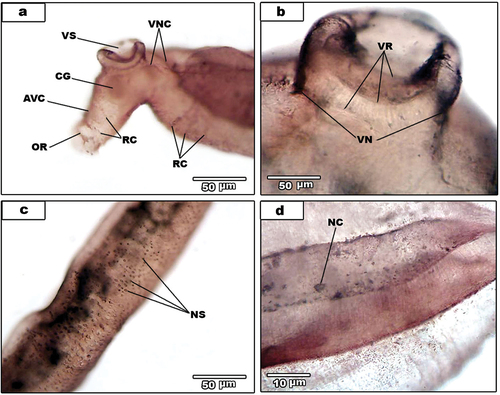 Figure 1. Light micrographs for AgNO3-treated male S. mansoni. (a). Nerve sensilla (NS) of dorsal surface of the middle region. (b). Venteral sucker showing ventral nerve of the sucker (VN) and venteral sucker rings (VR). (c). Anterior region of the male. Showing anteroventral connectives (AVC), cereberal ganglia (CG), oral sucker ring (OR), ring commissures (RC), venteral nerve cord (VNC) and venteral sucker (VS). (d). Dorsal surface showing nerve cell (NC).