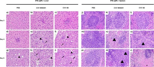Figure 4. Cache Valley Virus (CVV) infection shows histological effects in livers and spleens of 1-year-old IFN-αβR-/- mice. H&E-stained micrographs of liver (a–i) and spleen (j–r). Liver sections were evaluated for evidence of hepatocyte degeneration characterized by vacuolation of the cytoplasm (arrowhead); cell death characterized by cell swelling, hypereosinophilia of the cytoplasm, and fragmentation of the nucleus (arrow); and degree of inflammation which was predominantly composed of neutrophils and variable numbers of macrophages. Spleen sections were evaluated for inflammation which was predominantly composed of neutrophils (arrowheads) as well as evidence of cell death characterized by necrosis and cellular debris (asterisk). Images were captured at 40x magnification.