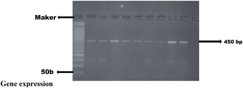 Figure 1. Gel image capture cDNA quantification of samples done in triplicate, GAPDH with expected amplicons band size of 450 bp.