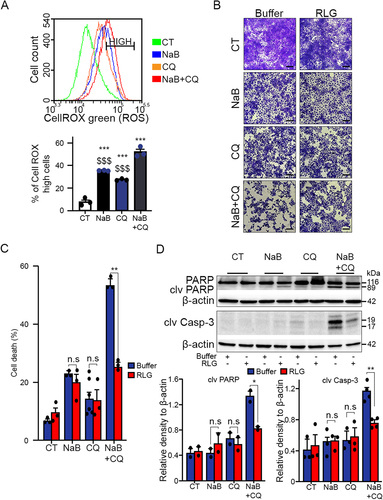 Figure 6. Oxidative stress-induced ROS generation induces death in cancer cells subjected to NaB and CQ. (A) Reactive oxygen species (ROS) levels in HuH-7 cells exposed to sodium butyrate (NaB, 4mM), chloroquine (CQ, 20µM), or both for 72h, measured by flow cytometry with the green fluorescent probe CellROX. Top: Representative flow cytometry curves. Cells with high CellROX content (HIGH): the 7% most strongly fluorescent cells in the unexposed CT control condition. Bottom: Percentage of cells in the high intensity range in 3 independent experiments. (B) Representative photographs of crystal violet-stained cells exposed to the indicated agents in the presence or absence of reduced L-glutathione (RLG, 5mM) for 72h. Three independent experiments. Scale bars, 200µm. (C) Cytometric quantification of cell death by propidium iodide staining. Three independent experiments. (D) Western blot analysis of PARP, cleaved PARP (clv PARP) and cleaved caspase 3 (clv Casp-3). Mean ± SEM densitometry quantification from 2-4 independent experiments. Statistical comparisons were made using Anova for A and Student’s t test for C and D. *, $ p<0.05; **, $$ p<0.01; ***, $$$ p<0.001. For panel 6A: < indicates statistical comparison with untreated cells (CT) and $ indicates statistical comparison with [Bu+CQ]-treated cells. NS or no statistical indication, no significance.