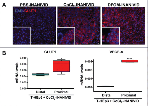 Figure 6. Generation of defined microenvironments via the iNANIVID. (A) Protein expression of membrane GLUT1 (red) and DAPI nuclear stain (blue) is shown in HEp3 tumors exposed to PBS, CoCl2 or DFOM loaded devices. Insets added to show detail. (B) GLUT1 and VEGF-A mRNA expression in the proximal and distal regions to the outlet of the CoCl2-iNANIVIDs (*, p<0.05; ****, p<0.0001). p values calculated with Student's t-test.