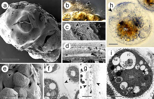 Figure 3. Tomont of I. multifiliis. (a) Holistic view of the tomont enveloped by cyst wall. (b) the cyst wall trapped with bacteria and debris (arrowhead). (c, d) Multi-layers of the cyst wall. Arrowheads and “*” indicated the separated layers. (e) Dividing offspring. Arrow indicates the cyst wall and arrowhead indicates the inner membrane. (f and g) Inner membrane (arrowheads) of tomont. (h, i) Holistic view of the offspring in tomont. arrowhead showed the cytostome. FV, food vacuoles; Ma, macronucleus; Mi, micronucleus. Scale bars 50 μm (a, e), 20 μm (b), 10 μm (f, h, i), 1 μm (d, g), 500 nm (c).