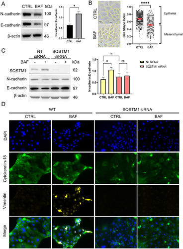 Figure 8. SQSTM1 mediates autophagy inhibition-induced epithelial-mesenchymal transition in chorion trophoblast cells.