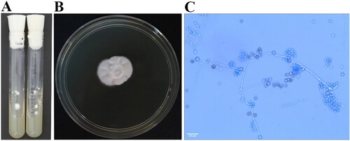 Figure 4. Macroscopic and microscopic characteristics of Hormographiella aspergillata. A: Skin tissue cultures on two Sabouraud dextrose agar (SDA) slopes both yielded multiple white, cotton-like, dense pure colonies after seven days of incubation at 25°C. B: White cotton-like colonies on an SDA plate after 10 days of incubation at 35°C. C: Lactophenol cotton blue mount of H. aspergillata slide culture showing branched, septate hyphae with cylindrical arthroconidia accumulating around the conidiophore (original magnification ×400).