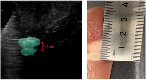 Figure 7. Comparison of AI-labeled B-mode ultrasound image with photographs of chicken sample post-ablation from sonications 1 and 2 at. P1