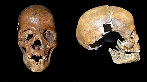 Figure 6. Skull of Zg 3 in anterior and lateral view.