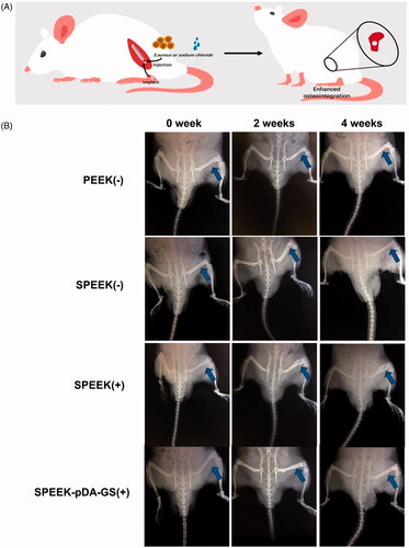 Figure 6. (A) Schematic illustration of the in vivo process of the implant for the uninfected (-) or infected (+) rat. (B) X-ray images of rats of PEEK (-), SPEEK (-), SPEEK (-), and SPEEK–pDA–GS (+) groups at 0, 2, and 4 weeks after surgery. The blue arrow indicates the implantation site.