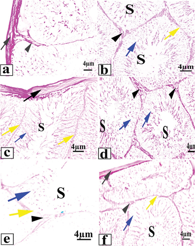 Figure 2. A photomicrograph of testicular tissue (a,b): control; (c,d): saffron group showing strong PAS reaction as a magenta color; (e): khat group showing weak reaction of PAS reaction as a magenta color; (f): khat and saffron group showing moderate PAS reaction as a magenta color. Tunica albuginea (black arrow), the membrane of the seminiferous tubule (yellow arrow); spermatogenic cells (blue arrow); sperm (S) and the connective tissues (arrowhead).