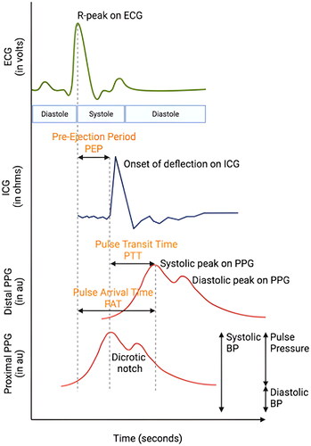 Figure 3. Determination of PAT and PTT in various modalities that combine photoplethysmography with biosignals for blood pressure estimation.ICG: impedance cardiography, SCG: seismocardiography, ECG: electrocardiography, IPG: impedance plethysmography, PPG: photoplethysmography, BCG: ballistocardiography, PAT: pulse arrival time, PTT: pulse transit time.Modified from Welykholowa et al [Citation198].