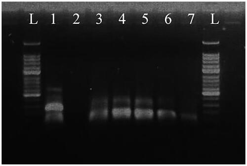 Figure 8. RT-MIRA products for the serial dilution of HAV vaccine strain H2 template separated on a 2% agarose gel. L: 50-bp DNA Ladder; 1: plasmid DNA template, positive control; 2: water template, negative control; 3: 106 copies/μl template; 4: 105 copies/μl template; 5: 104 copies/μl template; 6: 103 copies/μl template; 7: 102 copies/μl template