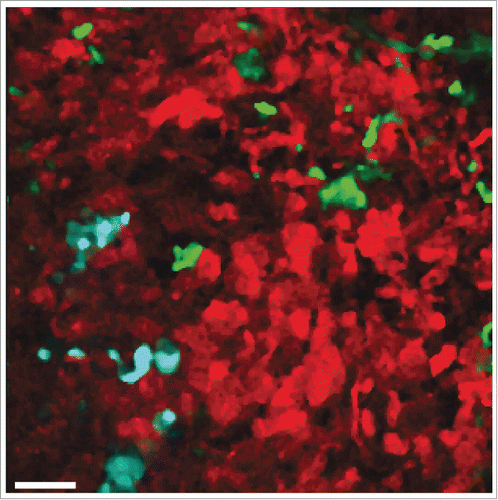 Figure 1. In vivo visualization of intratumoral EV-mediated transfer of Cre recombinase (seeCitation15). Multiphoton microscopy image of a tumor containing a mixture of human breast cancer-derived Cre-expressing T47D cells (cyan) and Cre-reporter-expressing MDA-MB-231 cells (red and green). MDA-MB-231 cells that took up Cre-containing EVs released by T47D cells switch from DsRed to GFP expression. Scale bar represents 50 µm.