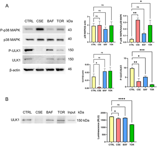 Figure 6. Oxidative stress and induction of autophagy lead to the activation of p38 MAPK and a concomitant decrease in ULK1 activation in amnion epithelial cells.