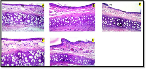 Figure 11 Light photomicrograph of (A) untreated rat epithelium and rat epithelium treated with (B) normal saline pH 6.8, (C) Drug solution, (D) F9 and (E) G2. “m”, mucosa; “c”, underlying cartilage; “o”, lamina propria of the mucosal layer; “v”, blood vessels in lamina propria.