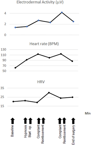 Figure 1. Neurovegetative Fluctuations During Third Molar Removal in a Highly Hypnotizable Patient, Reflecting the Fear of Not Being Able to Face Operation