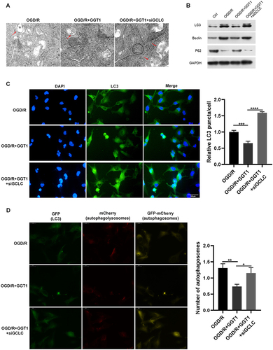 Figure 6 GGT1 targeting GCLC inhibited autophagy in RGC-5. (A) TEM images showing the mitochondria structure in cells after GGT1 overexpression and GCLC knockdown, full-length blots are presented in Supplementary Figure 1. (B) The proteins expression was detected using Western blot assay. (C) Immunofluorescence staining of LC3 in cells was visualized. (D) mCherry-EGFP-LC3-based immunofluorescence staining of autophagolysosomes (red) and autophagosomes (yellow) in RGC-5 cells. *p < 0.05, **p < 0.01, ***p < 0.001, ****p < 0.0001.