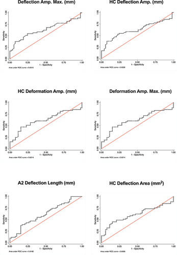Figure 2 Best receiver operating curves (ROC) for biomechanical parameters, including area under curve (AUROOC) to discriminate groups (pair 1): HMG (high myopia with glaucoma) and HMNG (High myopia without glaucoma).