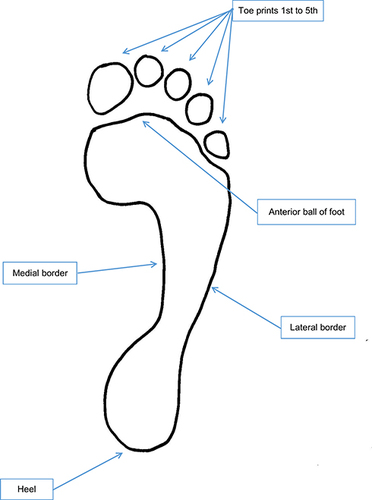 Figure 7 Morphological features of the footprint.
