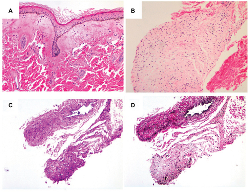 Figure 3 Skin pathology.