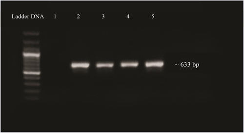Figure 8. PCR confirmation of gene ligation in E. coli plasmid. Lane 1: negative control. Lane 2–5: amplified product of gene.
