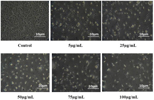 Figure 5. In vitro cytotoxicity of synthesized ZnONPs against L929 cell lines at various concentrations.