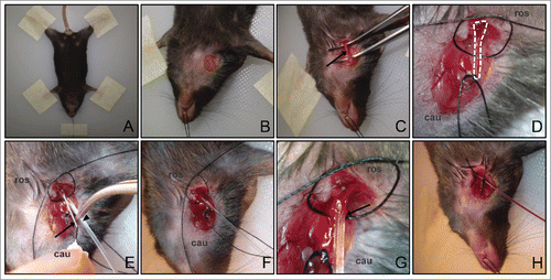 Figure 1. Setup for jugular vein catheterization procedure. (A) Mouse limbs and head are securely taped down to the board. (B) Small window of skin is removed at the neck region to expose the jugular vein. (C) The vein is clearly exposed (arrow) after the surrounding muscle and fat tissues are teased away. (D) Two sutures are passed underneath the jugular vein. A knot is tied with the bottom suture at the caudal end (labeled ‘cau’) to stop the blood flow. A loose knot is tied with the top suture at the rostral end (labeled ‘ros’), which will be tightened at the end of the procedure. (E) The 30G needle tip (arrow) is used to guide the insertion of the catheter (arrowhead) into the jugular vein. (F) The catheter is properly inserted into the vein and the needle tip is removed. (G) Close up of the catheter inserted into the vein. Arrow indicates the location where the catheter is inserted into the jugular vein. (H) The catheter is firmly secured with knots using both sutures. Backflow of blood in the catheter after drawing back the syringe indicates that the catheter is well inserted.
