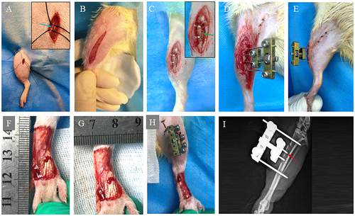 Figure 2 Procedure of TTT. (A) Four weeks after diabetes induction, the femoral artery (blue arrow) was exposed and ligated to induce hindlimb ischemia; and the incision was sutured. (B) A longitudinal 3-cm incision was made on the anteromedial aspect of the upper 1/3 of the calf, then the soft tissue was retracted and the periosteum was exposed. (C) Corticotomy (10 mm in height and 4 mm in width) was performed by drilling multiple successive unicortical holes (green arrow). Two 0.8-mm pins were inserted into the osteotomized fragment for transport while two 1.0-mm pins into the tibial shaft for anchor of the custom-made external fixator. The multiple drilling holes were connected using a small bone chisel to separate the cortex from the tibial shaft. (D and E) The external fixator was assembled and the incision was closed. (F–H) A rectangular wound (20 mm in length and 10 mm in width) was created by removal of full-thickness skin and subcutaneous tissues on the dorsum of foot. (I) Postoperative radiograph was taken to conform the sites of corticotomy (red arrow) and pins.