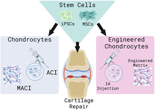Figure 3. The multiple cell therapies for cartilage repair. This schematic depicts the multiple cell types and uses for cartilage defect repair. Here, we begin with autologous chondrocytes as seen in ACI and MACI. Then we move to stem cells, primarily MSCs and iPscs, which can be differentiated into chondrocytes and used in IA injection and matrices. The future of cell therapy focuses primarily with synthetically engineered chondrocytes or stem cell-derived chondrocytes for cartilage regeneration.