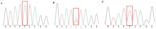 Figure 2. Sequencing peak of FGB gene in Hu sheep. (A): AA type, (B): at type, (C): TT type. Red box: the mutation site is FGB g.3378953 A > T.