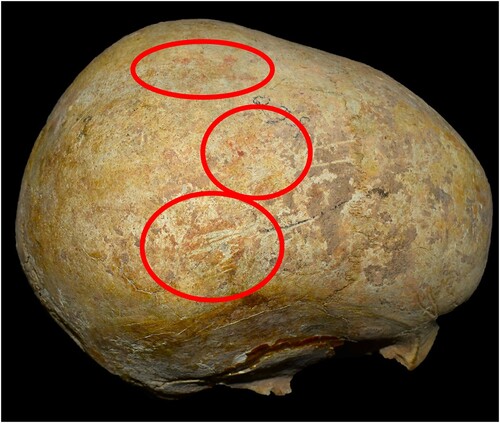 Figure 3. Skull of Zg1 from above. Note the ochre staining (red circles).