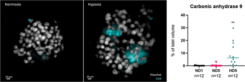 Figure 3. Left and central panels: representative 2D cross-sections in the middle of the human islets, with if for CA9 and Hoechst. CA9 is a trans-membrane protein, used here as a marker of hypoxia. Its presence after 5 days in normal culture conditions was sporadic (left), while under hypoxic conditions (group HD5, right), it could be found in all islets, expressed in large areas. Note the alteration in nuclear shape in areas around hypoxia. Right panel: quantification of CA9, expressed as percentage of total islet volume, showing significant presence of CA9 after 5 days in hypoxia.