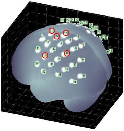 Figure 1 The channels of the left hemisphere functionally identified as motor areas (red circles).