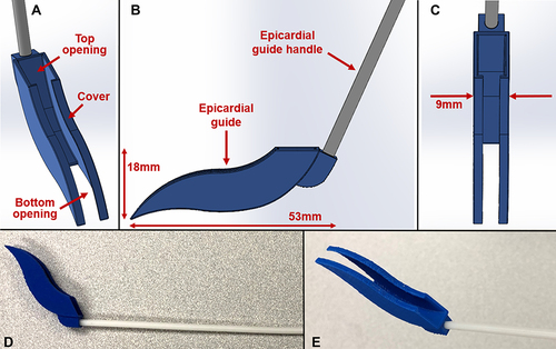 Figure 3 Design and prototype of the epicardial guide. The shape of the epicardial guide is designed to conform to the exterior surface of the heart. (A) Isometric view. The top opening allows for insertion of the superior suction base with the suction line and introducer arm attached. The bottom opening allows for the superior suction base to exit and continue on towards the target region on the heart, either anteriorly or posteriorly. The cover on opposite sides prevents premature exit of the superior suction base with an opening less than the width of the superior suction base introducer arm. (B) Side view. The epicardial guide handle is shown, controllable by the operator. (C) Top view. (D) and (E) Side and isometric views of the prototyped epicardial guide and handle.