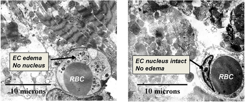 Figure 2 Transmission electron microscopy (TEM) of porcine myocardium at 3 hrs of reperfusion following 1 hr of coronary occlusion. Representative images from control (left panel) and SSO2-treated (right panel) groups (masked assignment selection by cardiac pathologist [Vander Heide R]) (data from Spears et al,Citation117). EC = Endothelial Cell. RBC = Red Blood Cell (within lumen of EC). EC edema, loss of EC nuclei, and prominent disruption of myofibrillar structure was evident in the Control group only. Reprinted by permission from Springer Nature (Springer Nature) (Am J Cardiovasc Drugs) (Hyperoxemic perfusion for treatment of reperfusion microvascular ischemia in patients with myocardial infarction) Bartorelli AL., Copyright (2003).Citation120
