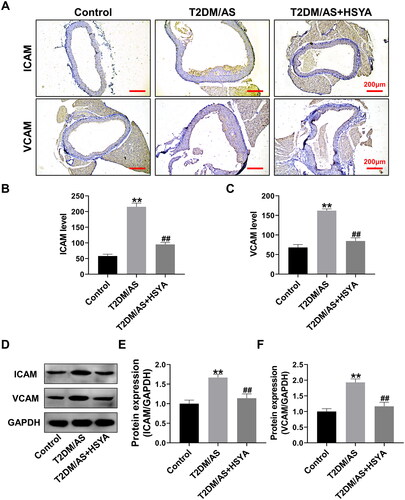 Figure 2. HSYA inhibits the expression of aortic ICAM and VCAM proteins (A) the expression intensity and distribution of ICAM and VCAM proteins in the aorta of mice in each group (n = 3) were detected by immunohistochemistry; (B andC) IPP 6.0 software was used to statistically Quantify the optical density values of the immunohistochemical detection results; (D andF) the ICAM and VCAM expression levels in the aortic tissues of the mice in each group (n = 3) were detected by western blotting, and the optical density values of the protein bands were statistically quantified using ImageJ software. **p < 0.01, *p < 0.05, compared with the control group; ##p < 0.01, #p < 0.05, compared with the T2DM/AS group; the difference was statistically significant.