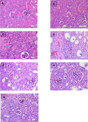 Figure 5. Histology of kidney mice administrated with enalapril, Morus alba leaves extract, and chlorogenic acid in Haematoxylin and Eosin (H&E) staining. (A) Sham operation group (10 µm scale bar) shows the normal structure of glomerulus and tubules; (B) UUO group depicts interstitial fibrosis, Bowman’s space dilatation, and tubular epithelial cell loss with the intralobular eosinophilic cast (50 µm scale bar); (C) UUO group with higher magnification of group figure B (10 µm scale bar); (D) UUO group shows interstitial fibrosis, dilatation of tubules and infiltration of the inflammatory cell (10 µm scale bar); (E) UUO treated with enalapril group (10 µm scale bar); (F) UUO treated with Morus alba leaves extract (10 µm scale bar); (G) UUO treated with chlorogenic acid (10 µm scale bar). G: glomerulus; P: proximal tubule; D: distal tubule; yellow arrow: intralobular cast; blue arrow: fibrosis; red arrow: cellular inflammatory; black arrow: tubular dilation.