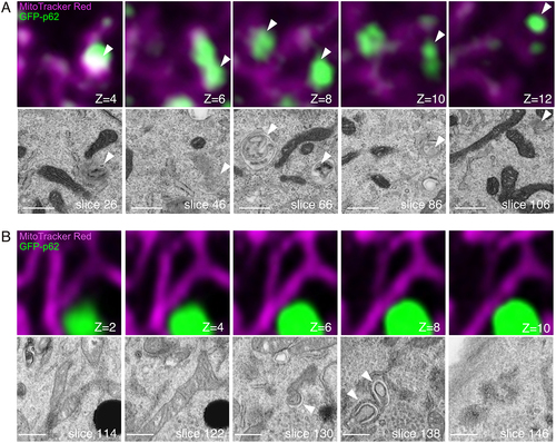 Figure 3. Volume CLEM analysis of WT and atg7 KO MEFs. MEFs expressing GFP-p62 (green) were labeled with MitoTracker Red (magenta). Serial images were taken with FM and FIB/SEM. (A) CLEM images of the WT cell. (B) CLEM images of the atg7 KO cell. The optical slice thickness of FM z-stacks is 200 nm (A) or 80 nm (B). Arrowheads indicate p62-containing autophagic vacuoles (WT), or phagophores adjacent to p62 aggregates (atg7 KO). Scale bars, 500 nm.