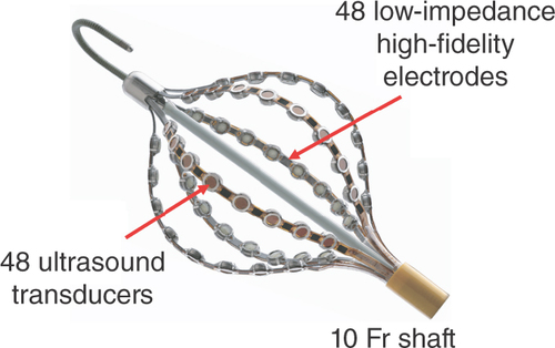 Figure 1. Rendering of the AcQMap non-contact catheter, displaying the interspersed electrodes and transducers at the distal end of a 10 French size catheter.