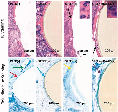Figure 9. Histological analysis of the in vivo bone integration using HE and toluidine blue staining methods in PEEK (-), SPEEK (-), SPEEK (+), and SPEEK–pDA–GS (+) groups, respectively.