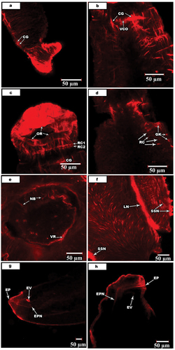 Figure 5. Confocal laser scanning micrographs of nerve activities in S. mansoni and S. haematobium.