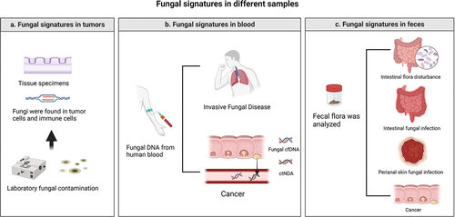 Figure 1. Diseases that require differential diagnosis. (a) Laboratory fungal infections should be considered during biopsy of tumour tissue. (b) Tumor patients are often immunosuppressed after chemotherapy and radiotherapy and are prone to invasive mycosis. Therefore, fungi and fungal antibodies can also be found in the blood. (c) If a change in faecal fungal flora abundance is found, in addition to considering CRC, intestinal flora disorders, fungal intestinal infections, and perianal skin infections should also be considered.