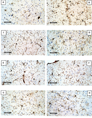 Figure 4 Immunohistochemical expression of Iba1 in the brain of mice. (A) GI (normal control) have low expression of Iba1. (B) GII and (C) GIV revealed an increase in Iba1 level. (D-H) represent the remaining treated groups, which revealed reduced expression in Iba1 level.