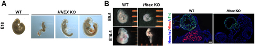 Figure 1 Phenotypes of wild-type: WT and HHEX knockout: KO embryos. (A) E18 pig embryos; (B) E9.5 and E10.5 mouse embryos and Hhex KO.
