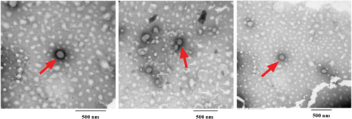 Figure S3 Negatively stained TEM imaging of aliphatic hydrocarbon globules in solvent (1% uranyl acetate). Red arrows indicate the presence of hydrocarbon globules.