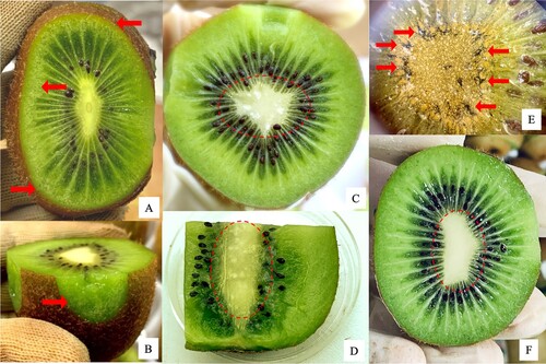 Figure 4. Symptoms of disorders on ‘Hayward’ kiwifruit. A, B: chilling injury (CI). C, D: white core inclusion (WCI). E: WCI dyed with potassium iodide solution in the transection of kiwifruit core tissue. The image scale is indicated by the kiwifruit seeds. The arrows point to starch clusters dyed in black. F: Healthy fruit.