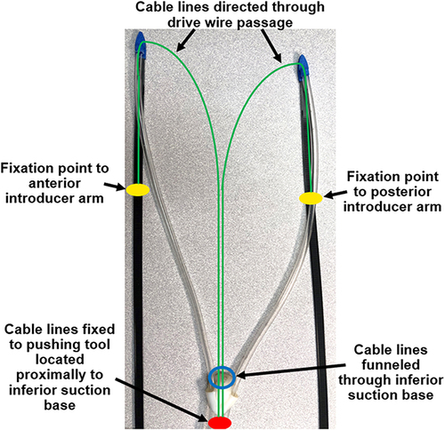 Figure 9 Introducer Mechanism II. This mechanism functions through the pushing tool, indicated in red, that directs the inferior suction base towards the apex of the heart. Cable lines, shown in green, which travel from the pushing tool to the introducer arms, passing through the drive wire passages on the superior suction bases, are pulled in order to propel the pushing tool forwards.