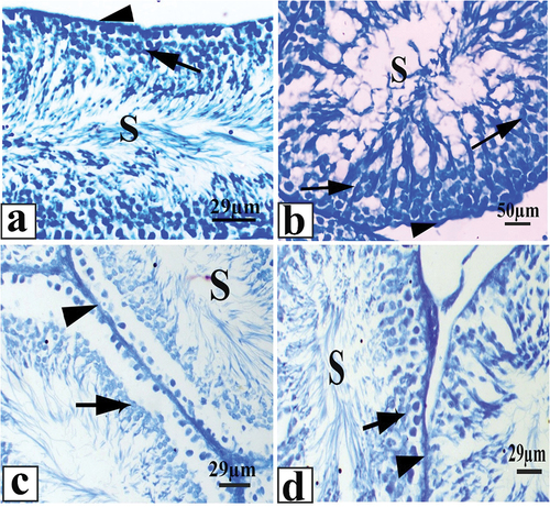 Figure 3. A photomicrograph of testicular tissue (a): control, (b): saffron group showing high protein content (c): rat treated with khat for 3 months showing a reduction in the protein content (d): rat treated with khat and saffron for 3 months showing a moderate increase in the protein content; membrane of seminiferous tubules (arrowhead), spermatogenic cells (arrow), and sperms (S); (bromophenol blue).