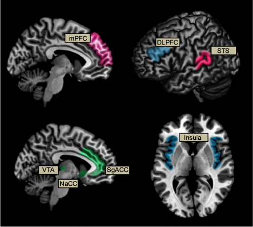Figure 2 Schematic representation of neural activation associated with altruistic behavior during fMRI.